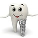 Dental Implant Planning