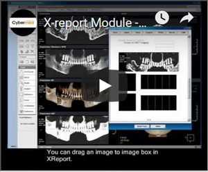 Link to YouTube Video - OnDemand3D Video Manual  X-report Module - Write / Export / Print